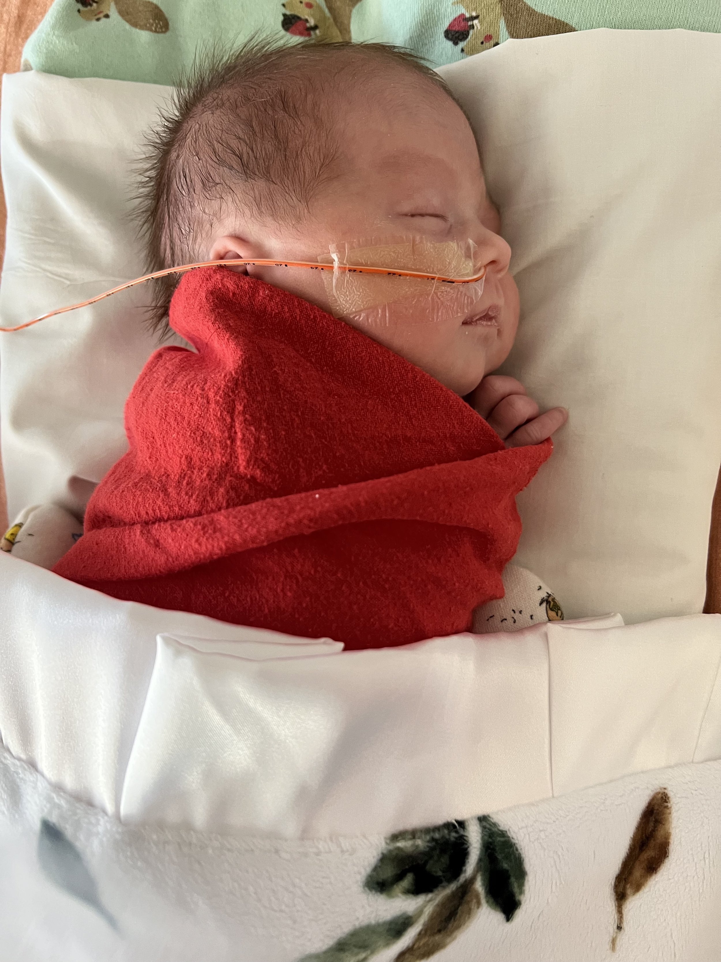 Swaddled premature infant with feeding tube lying in NICU bassinet