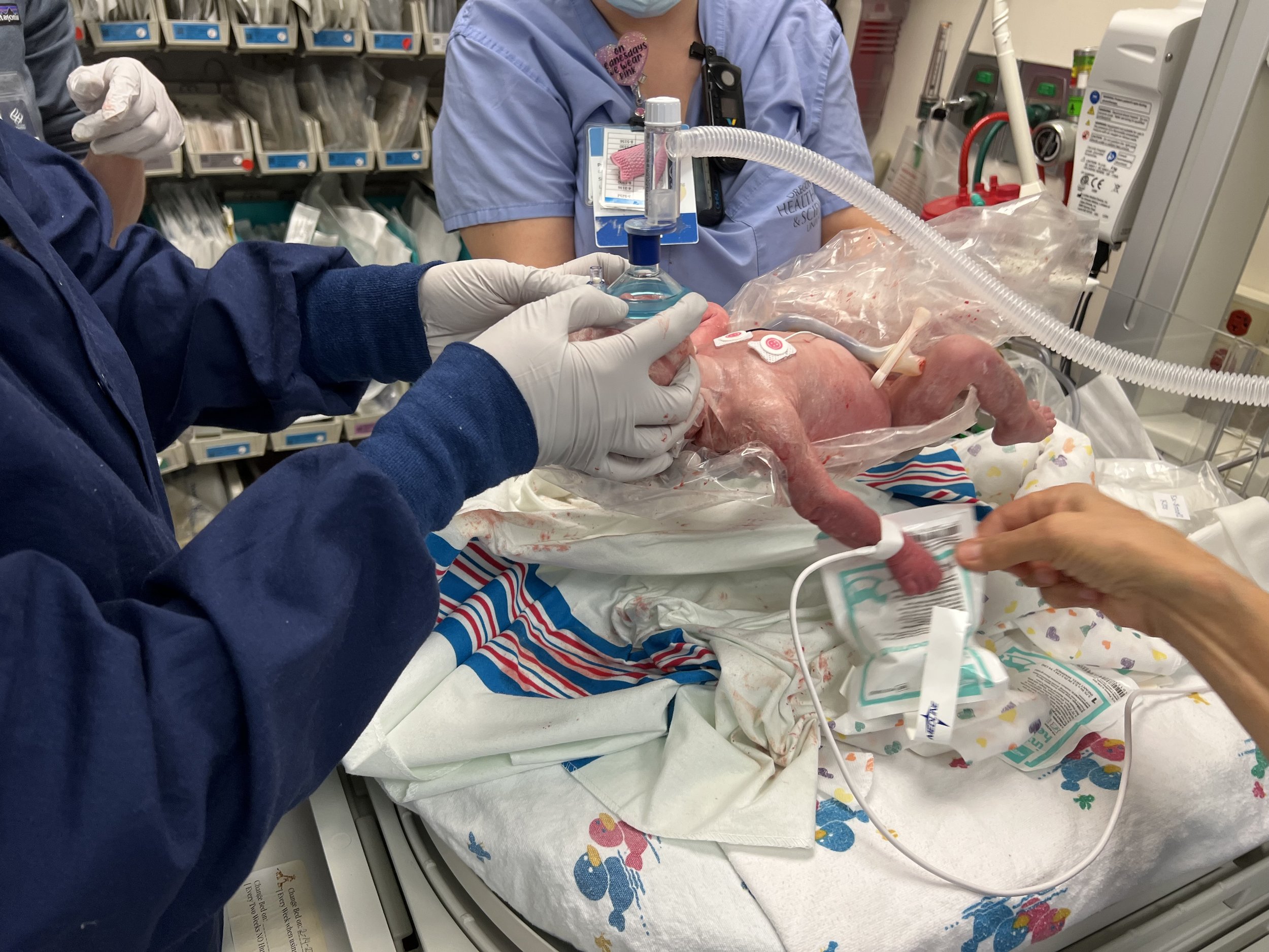 Resuscitating a newborn infant