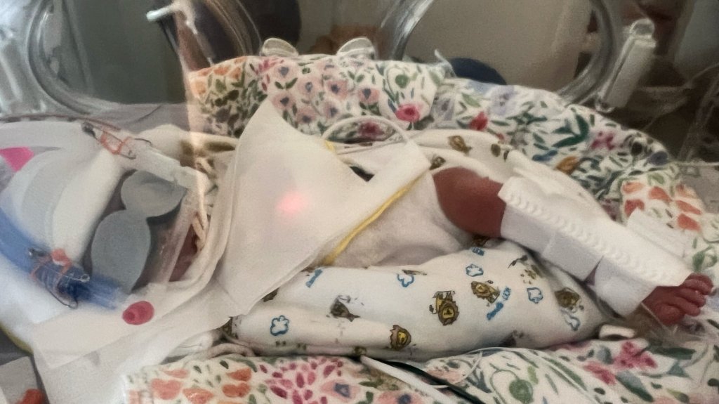 5 Things We Didn’t Expect About the NICU